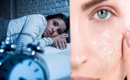 Eğer günde 8 saat uyumuyorsanız… Cildinize bunlar olabilir!
