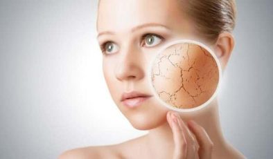 Cilt kuruluğu hangi vitamin eksikliğinden, neden olur? Cilt kuruluğu belirtileri…