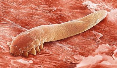 Yetişkinlerde kıl kurdu belirtileri: Kıl kurdu nasıl dökülür, düşürülür? Kıl kurdu zararları