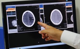 ALS hastalığı futbolcularda daha sık görülüyor! İşte nedeni…